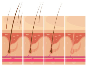 Hair Follicles: The Engine of Growth