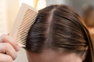 What Causes an Oily Scalp