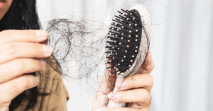 hair loss