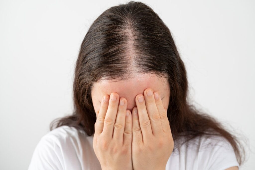 Hair Loss in Women: Causes, Myths & Solutions
