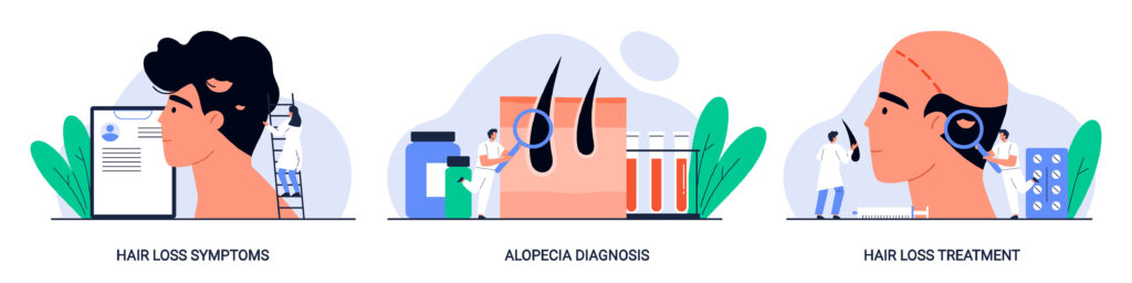 telogen effluvium and sudden hair shedding phases, hairsncares